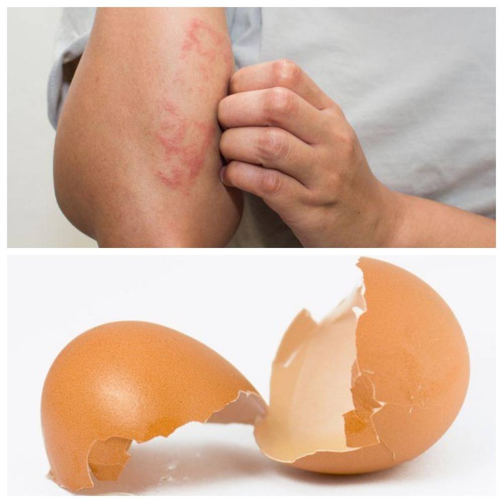 Цена выеденного яйца: вред и польза яичной скорлупы