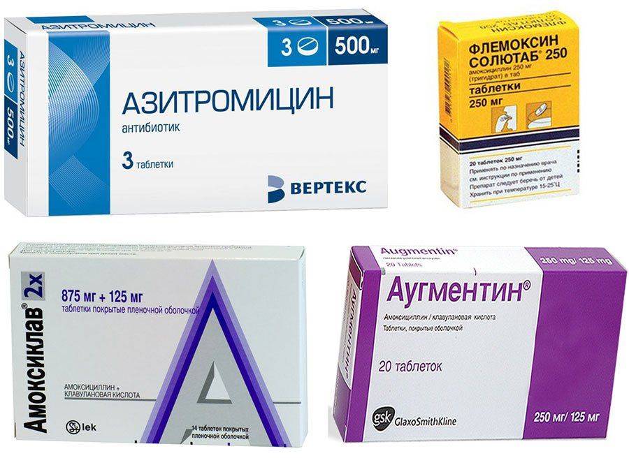 Азитромицин при орви. Антибиотики названия. Антибиотики в таблетках. Антибиотики названия препаратов. Название антибиотиков в таблетках.