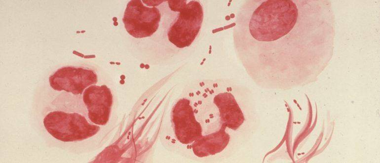 Гемоспермия — почему появляется кровь в сперме?