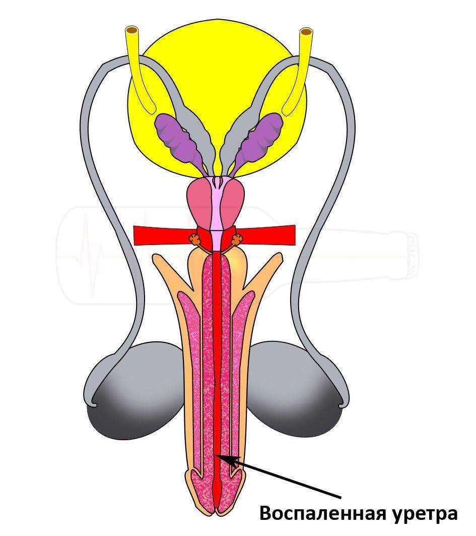 Уретра это. Мочеиспускательного канала (уретрит). Мочеиспускательный канал у мужчин уретра. Топография мочеиспускательного канала.