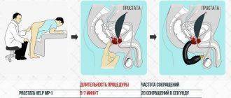 Обзор прибора Prostata Help Mp 1