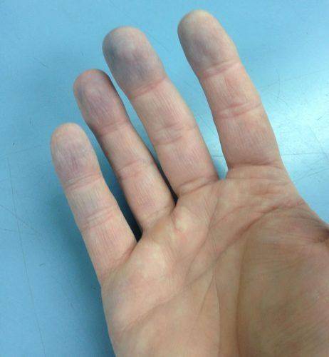 Синие пальцы