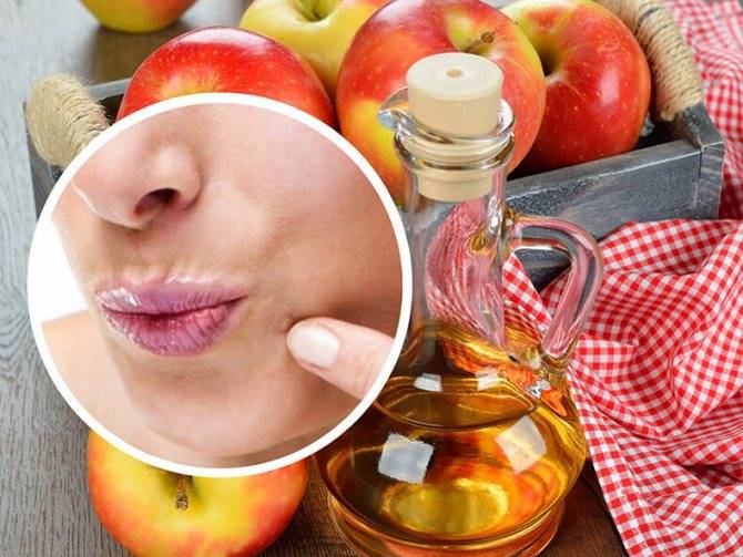 Польза и уникальные свойства яблочного уксуса