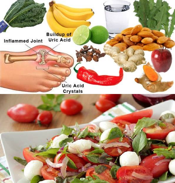 Какие фрукты можно есть при подагре. Продукты при подагре. Диетотерапия подагры. При воспалении суставов питание. Запрещенные продукты при подагре.
