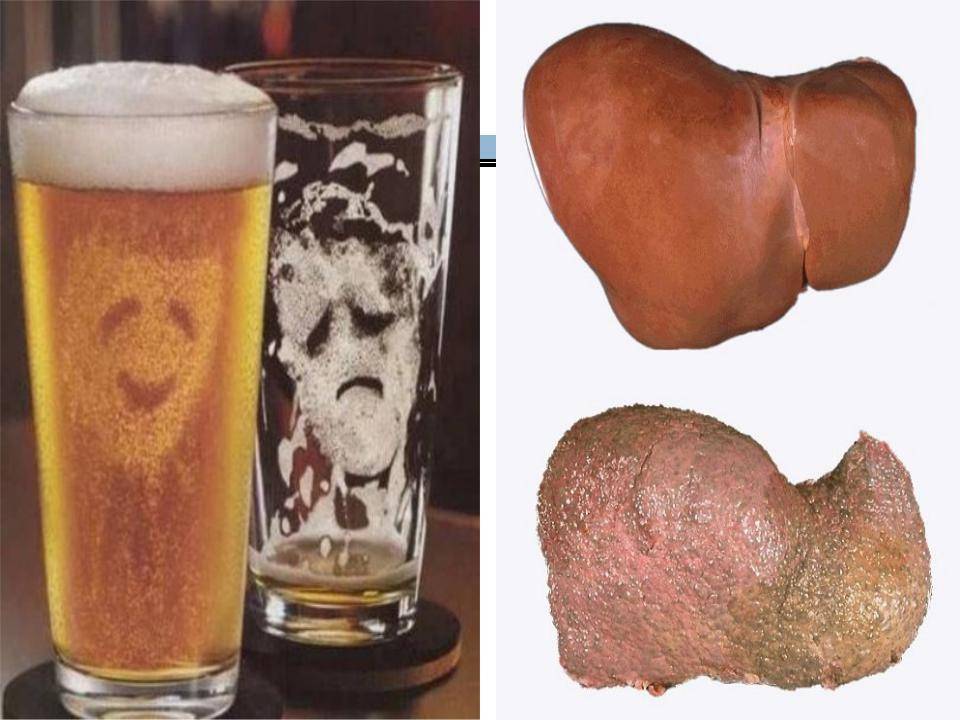 Влияние пива на мужской организм
